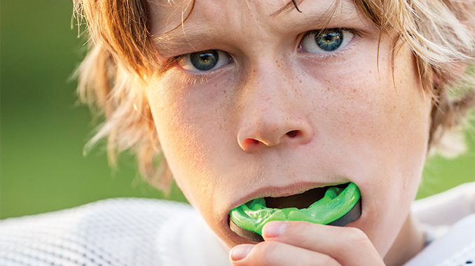 mouthguards-fet